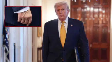 Beyaz Saray, Trump'ın vücudundaki şişlik ve morluklara ilişkin açıklama yayınladı