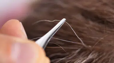 Erken beyazlayan saçlar hangi hastalıkların habercisi?