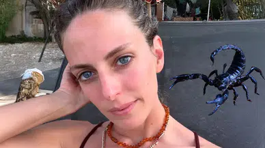 Bige Önal'ı akrep soktu, hastaneye yetiştiren oyuncu arkadaşı Necip Memilli oldu