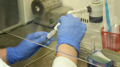 Lassa ateşi can almaya devam ediyor: 162 kişi hayatını kaybetti