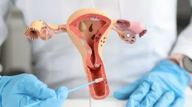 Çikolata kisti farkındalığı hayati: Nefes darlığı ve organ hasarı riski var