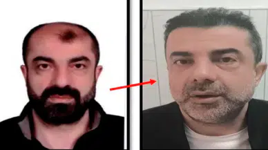 Cinayet şüphelisinden estetikli firar: Yüzünü değiştirdi ama adaletten kaçamadı
