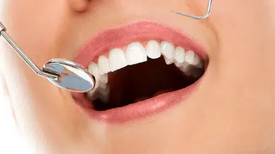 Şeker sanıldığı kadar suçlu değilmiş: Diş çürüğünde asıl dengeyi bozan şey ortaya çıktı