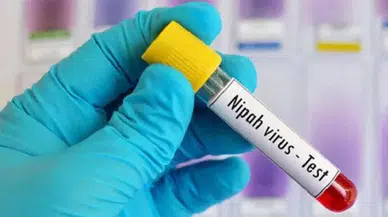 Hindistan Nipah virüsü: Türkiye'de var mı, nedir, nasıl bulaşır, aşısı var mı?