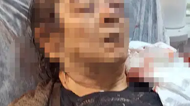 Kayseri'de korku dolu anlar: Evinde dinlenirken tavan başına çöktü