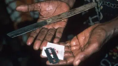 Ürküten gerçek: Dünyada 230 milyon kadın genital sakatlamaya maruz kaldı