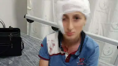 Köpek saldırısı sonrası mahkemeden emsal karar: Yüzündeki iz için dev tazminat