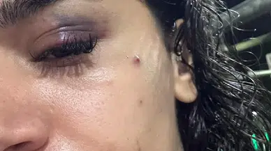 Uzaklaştırma kararı kalkan olmadı: Hemşire Ebru'nun çığlığına kulak verin