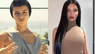 Cinsiyet değiştiren fenomen Beren Güney’den dikkat çeken estetik itirafı: Kemik eklettim