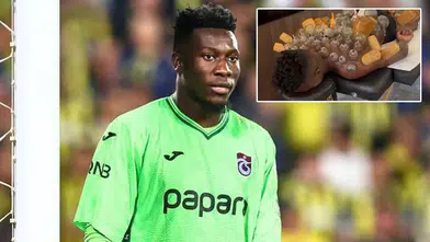 Trabzonsporlu kaleci Onana hacamat yaptırdı