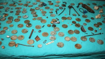 Midesinden 233 parça yabancı cisim çıkarılan hasta sağlığına kavuştu