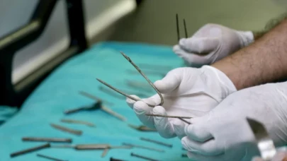 Van’da kadın hastanın midesinden 158 yabancı cisim çıkarıldı