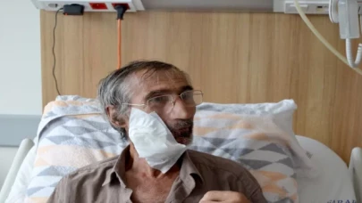 Trabzon’da, ağzındaki tümör nedeniyle su bile yutamayan hasta sağlığına kavuşturuldu