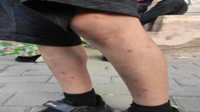 İstanbul’da sivrisineklerin görülme sıklığında artış yaşanıyor