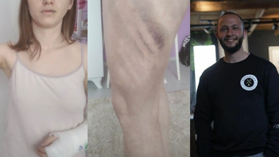 Kız arkadaşını beyzbol sopasıyla darp eden erkek tutuklandı