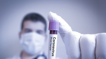 "Mavi" şehir Uşak da "Sarı"ya döndü...