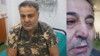Hasta yakınının yumruklu saldırısı sonucu doktor yaralandı