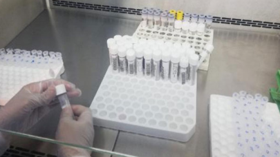 Koronavirüs tanılarının yüzde 95'i İngiltere mutasyonu