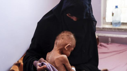 Milyonlarca insan açlıktan ölme tehlikesiyle karşı karşıya