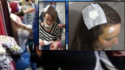 Yolda yürüyen kadına muşta ile saldırdı