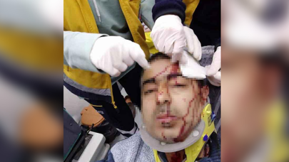 İmam, müezzine tabureyle saldırdı