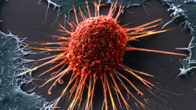 Kısıtlamalar nedeniyle Avrupa'da 1 milyon kanser vakası gözden kaçırıldı!