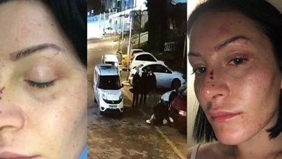 Polis tarafından dövülen Gökçe Yaşar konuştu