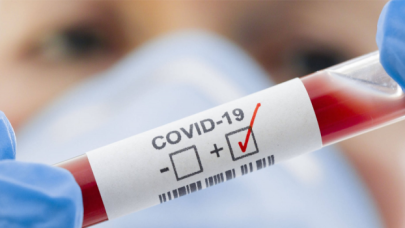 Kovid-19 geçirenler iki doz aşı olabilecek