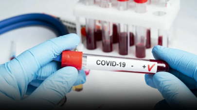 Hukukçular yanıtladı: PCR testi "zorunlu" tutabilir mi?