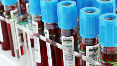 En sağlıklı kan grubu belli oldu