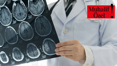 MS Hastalığı yani Multipl Skleroz hakkında her şey