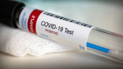 Tabipler Odası'ndan Omicron'a karşı önlem listesi