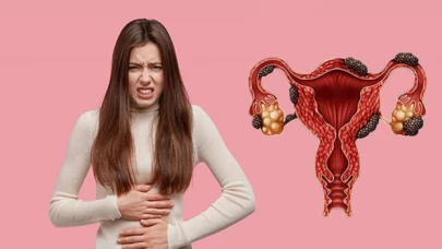 Çikolata kisti (endometriozis) önemli hastalıklara neden olabilir