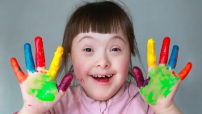 Down sendromu nedir? Down sendromu belirtileri nelerdir?