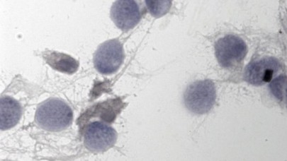 Erkekler için doğum kontrol hapı: %99 etkili