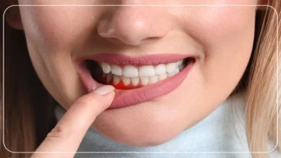 Diş Kaybının Nedenleri Nelerdir?