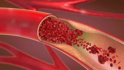 İnsan kanında plastik görülmesi ne anlama geliyor?