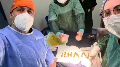 Safra kesesinden 1250 taş çıktı, doktor taşlarla ismini yazdı