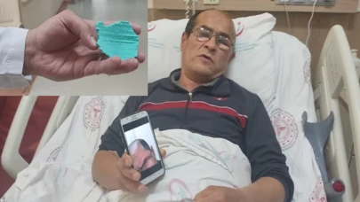 Kafatasına üç boyutlu yazıcıyla üretilen kemik takıldı