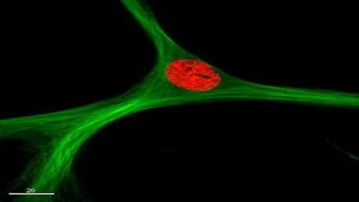 Kök hücreyle gençleşmek mümkün!