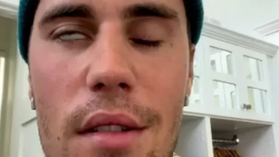 Ramsay Hunt sendromu nedir?