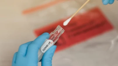 11-17 Temmuz'da 226 bin 532 kişinin testi pozitif çıktı