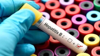 1998’den önce doğanlara ’hepatit’ uyarısı: Mutlaka test yaptırın