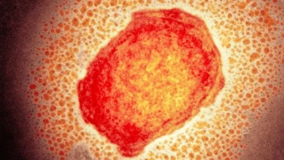 DSÖ Acil Durum Komitesi, maymun çiçeği virüsü için bir araya geldi