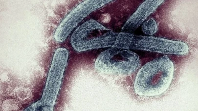 Gana’da ölümcül Marburg virüsü paniği: İki kişi hayatını kaybetti