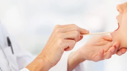 Kış aylarında yaygın görülen hastalık faranjit nedir?