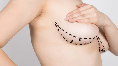 Meme küçültme ameliyatı hakkında merak edilenler