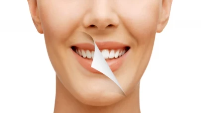 Diş bakımında dikkat edilmesi gerekenler