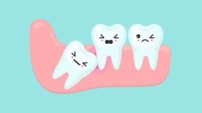 Yirmilik diş neden çıkar?