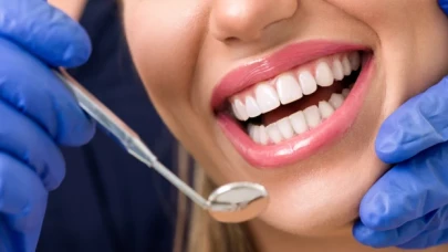 Diş beyazlatma hakkında bilinmesi gerekenler